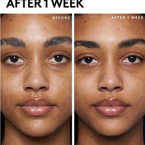 Fenty Skin Mask Cherry Hub 🍒 New in Box - Picture 2 of 4